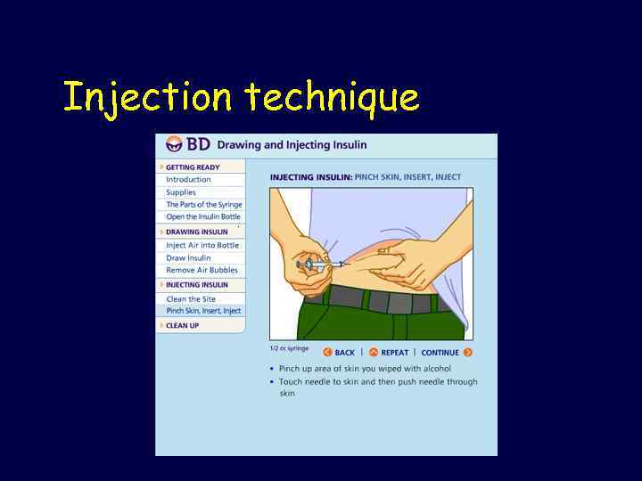 Injection technique 