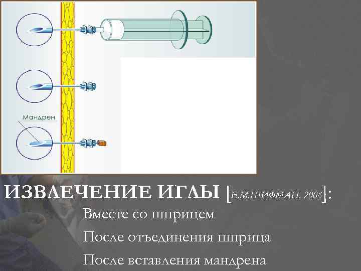 ИЗВЛЕЧЕНИЕ ИГЛЫ [Е. М. ШИФМАН, 2006]: Вместе со шприцем После отъединения шприца После вставления