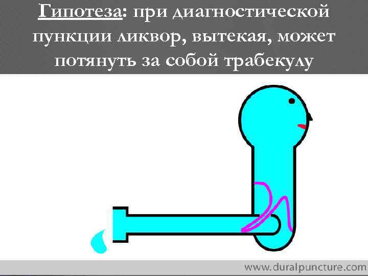 Гипотеза: при диагностической пункции ликвор, вытекая, может потянуть за собой трабекулу 2/16/2018 copyright (your