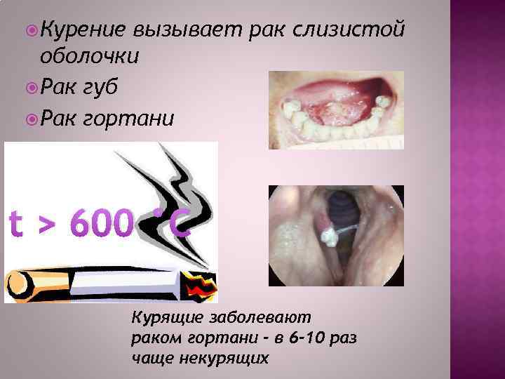  Курение вызывает рак слизистой оболочки Рак губ Рак гортани t > 600 °С