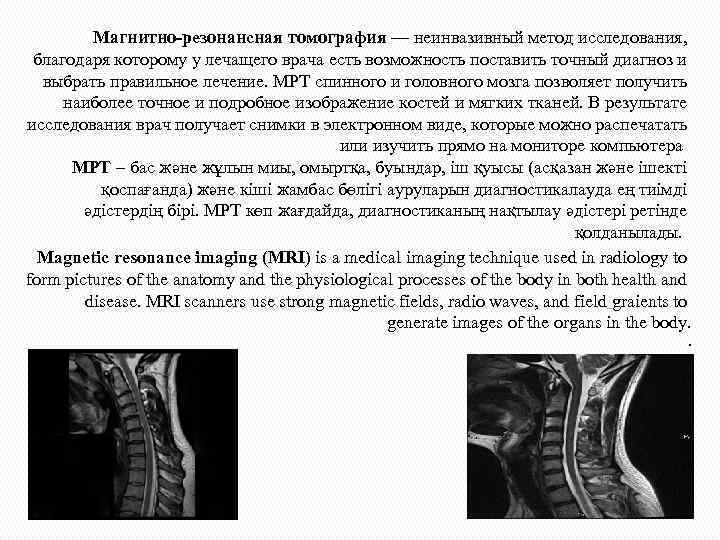 Магнитно-резонансная томография — неинвазивный метод исследования, благодаря которому у лечащего врача есть возможность поставить