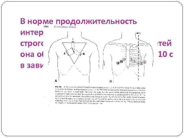 В норме продолжительность интервалов RR не должна быть строго одинакова и у здоровых детей