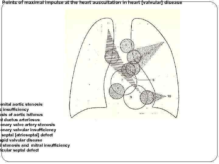 Points of maximal impulse at the heart auscultation in heart [valvular] disease genital aortic