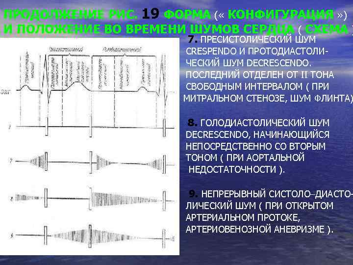 ПРОДОЛЖЕНИЕ РИС. 19 ФОРМА ( « КОНФИГУРАЦИЯ » ) И ПОЛОЖЕНИЕ ВО ВРЕМЕНИ ШУМОВ