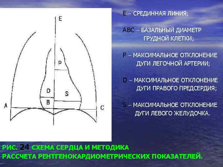 Е – СРЕДИННАЯ ЛИНИЯ; АВС – БАЗАЛЬНЫЙ ДИАМЕТР ГРУДНОЙ КЛЕТКИ; Р – МАКСИМАЛЬНОЕ ОТКЛОНЕНИЕ
