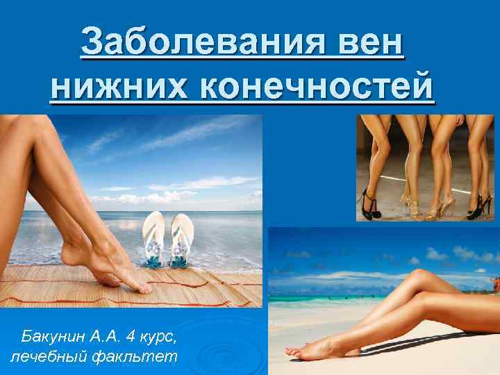 Заболевания вен нижних конечностей Бакунин А. А. 4 курс, лечебный факльтет 