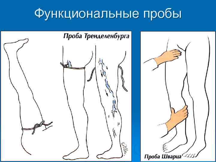 Функциональные пробы 
