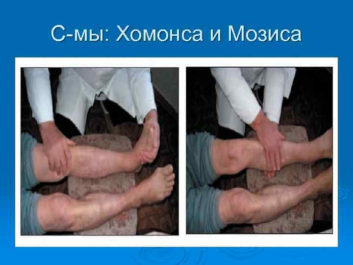 С-мы: Хомонса и Мозиса 