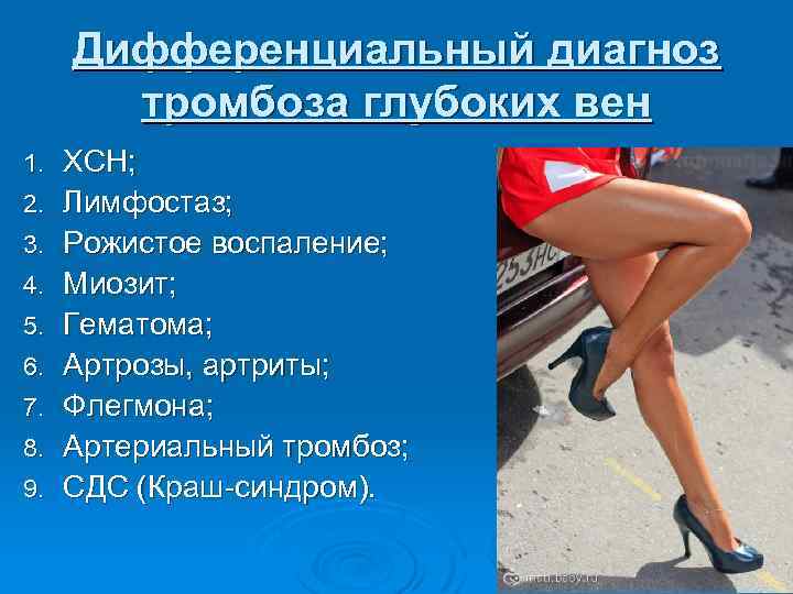 Дифференциальный диагноз тромбоза глубоких вен 1. 2. 3. 4. 5. 6. 7. 8. 9.