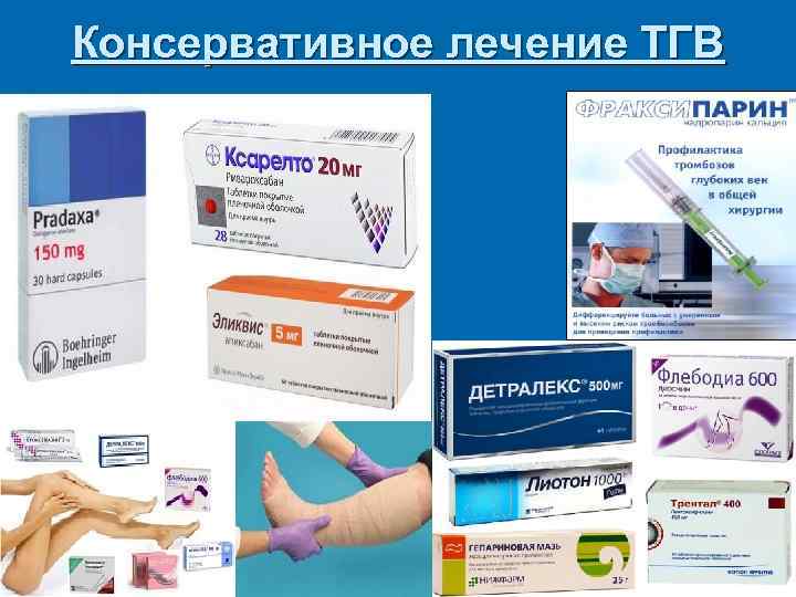 Консервативное лечение ТГВ 