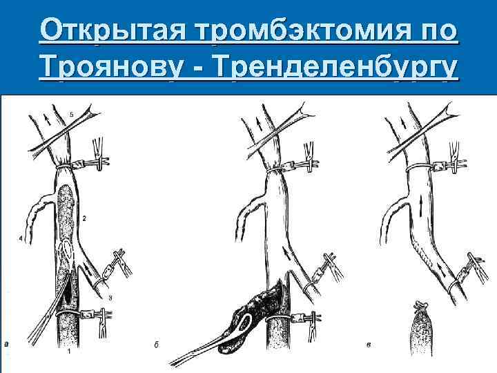 Операция троянова