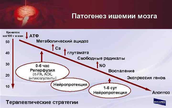 Патогенез ишемии мозга Кровоток мл/100 г в мин 50 АТФ Метаболический ацидоз Ca 40