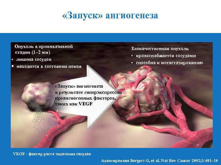  «Запуск» ангиогенеза Опухоль в преинвазивной стадии (1– 2 мм) • лишена сосудов •