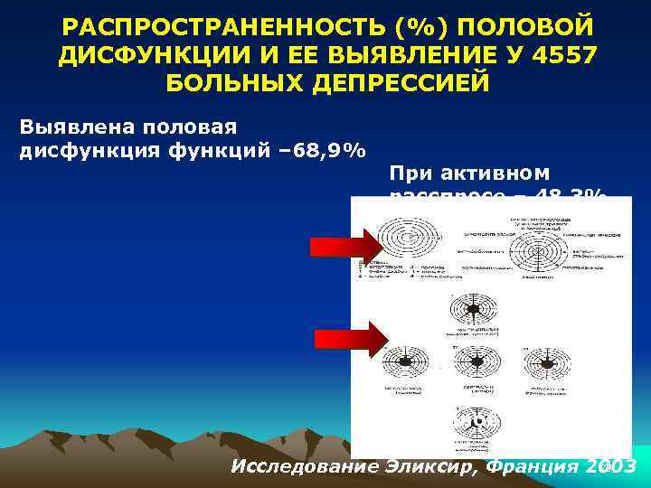 РАСПРОСТРАНЕННОСТЬ (%) ПОЛОВОЙ ДИСФУНКЦИИ И ЕЕ ВЫЯВЛЕНИЕ У 4557 БОЛЬНЫХ ДЕПРЕССИЕЙ Выявлена половая дисфункция