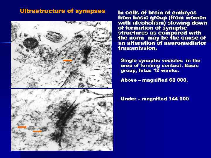 Ultrastructure of synapses In cells of brain of embryos from basic group (from women