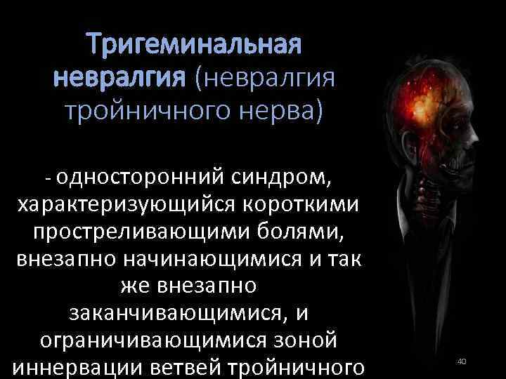 Тригеминальная невралгия (невралгия тройничного нерва) - односторонний синдром, характеризующийся короткими простреливающими болями, внезапно начинающимися