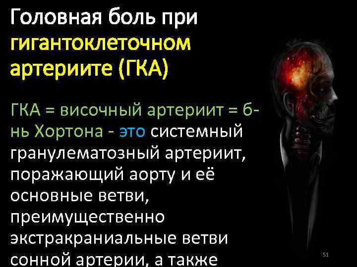 Головная боль при гигантоклеточном артериите (ГКА) ГКА = височный артериит = бнь Хортона -