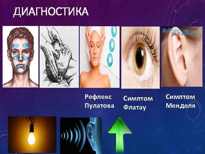 ДИАГНОСТИКА Рефлекс Пулатова Симптом Флатау Симптом Менделя 