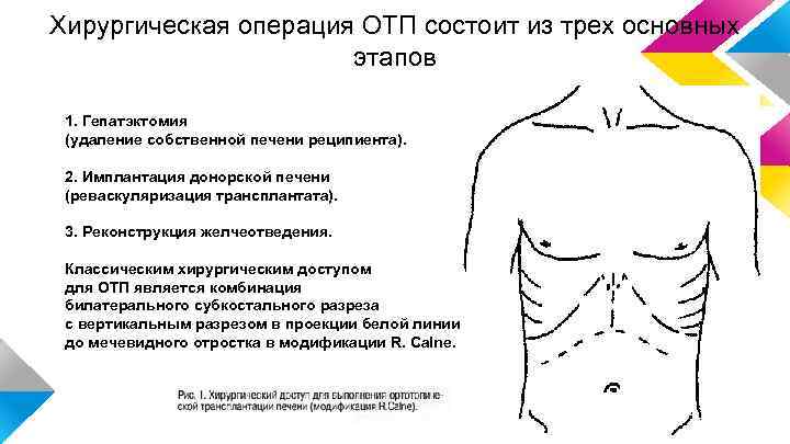 Доступ мерседес к печени