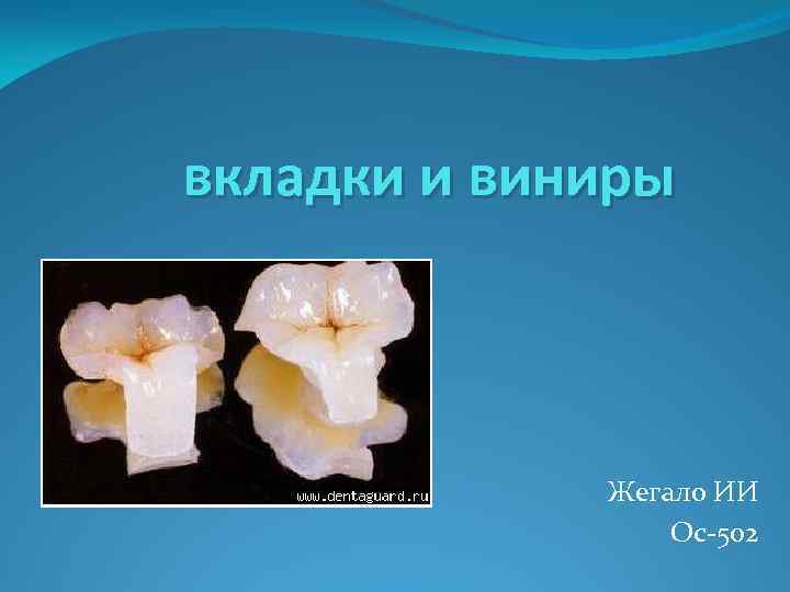 вкладки и виниры Жегало ИИ Ос-502 