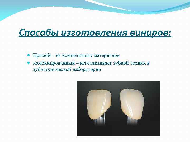 Способы изготовления виниров: Прямой – из композитных материалов комбинированный – изготавливает зубной техник в