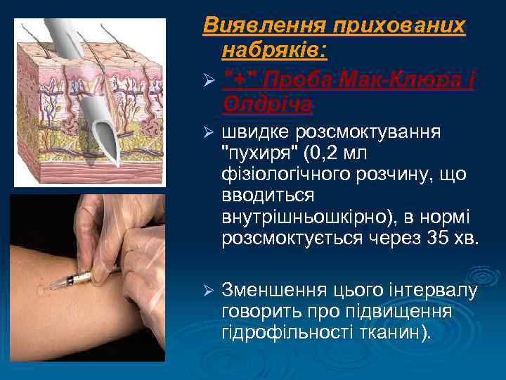 Виявлення прихованих набряків: Ø 