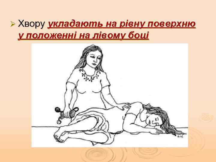 Ø Хвору укладають на рівну поверхню у положенні на лівому боці 