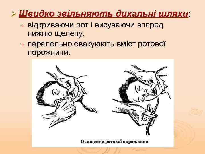 Ø Швидко звільняють дихальні шляхи: v v відкриваючи рот і висуваючи вперед нижню щелепу,