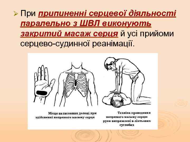 Ø При припиненні серцевої діяльності паралельно з ШВЛ виконують закритий масаж серця й усі
