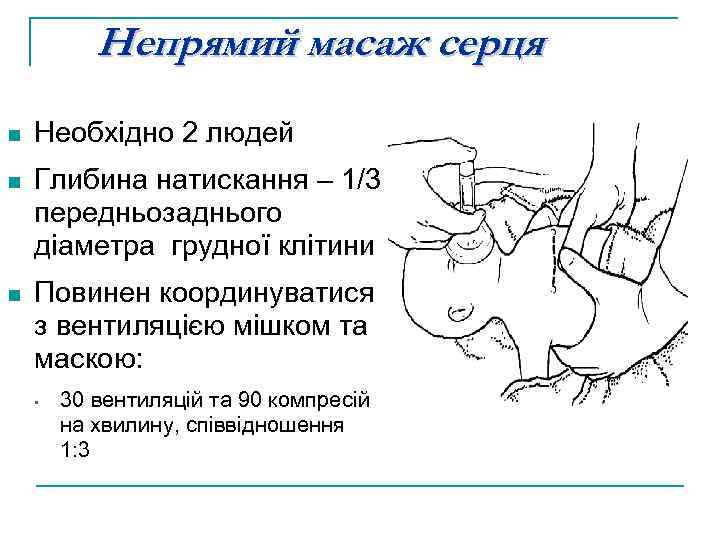 Непрямий масаж серця n Необхідно 2 людей n Глибина натискання – 1/3 передньозаднього діаметра