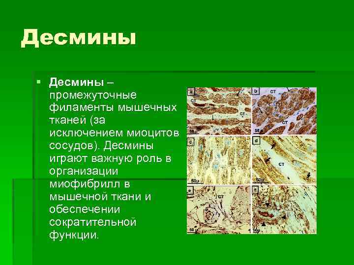 Десмины § Десмины – промежуточные филаменты мышечных тканей (за исключением миоцитов сосудов). Десмины играют