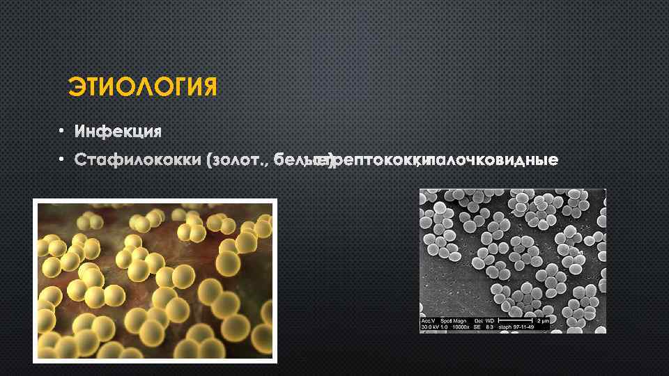 ЭТИОЛОГИЯ • • 