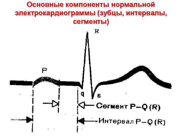 Происхождение зубца r на экг связано с