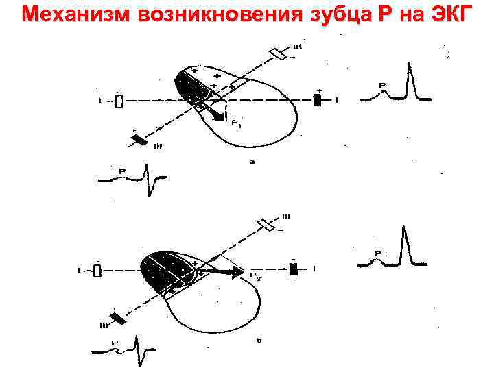 Механизм возникновения зубца Р на ЭКГ 