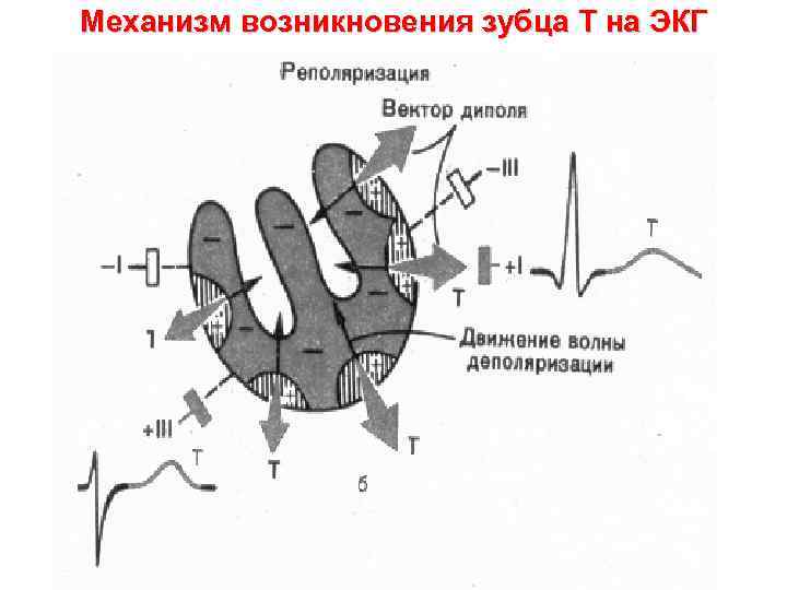 Механизм возникновения зубца T на ЭКГ 