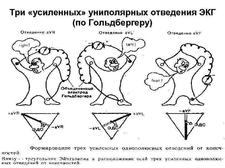 Усиленные отведения экг схема