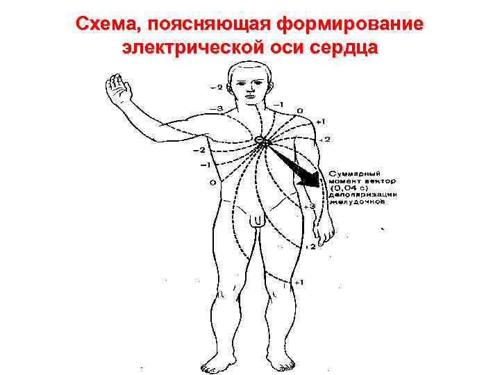 Схема, поясняющая формирование электрической оси сердца 