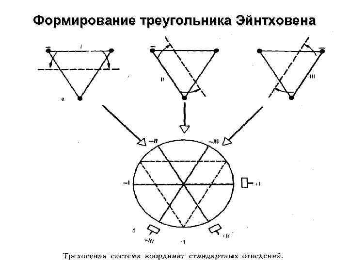 Формирование треугольника Эйнтховена 