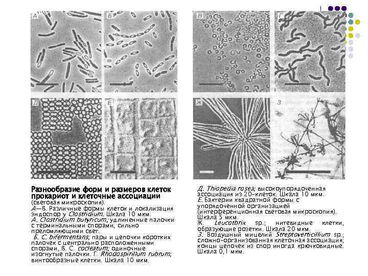 Разнообразие форм и размеров клеток прокариот и клеточные ассоциации (световая микроскопия). А—ß. Различные формы