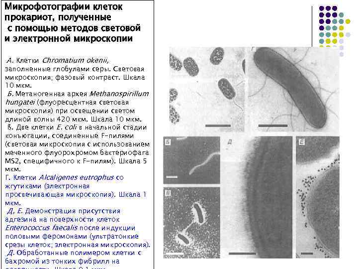 Микрофотографии клеток прокариот, полученные с помощью методов световой и электронной микроскопии А. Клетки Chromatium