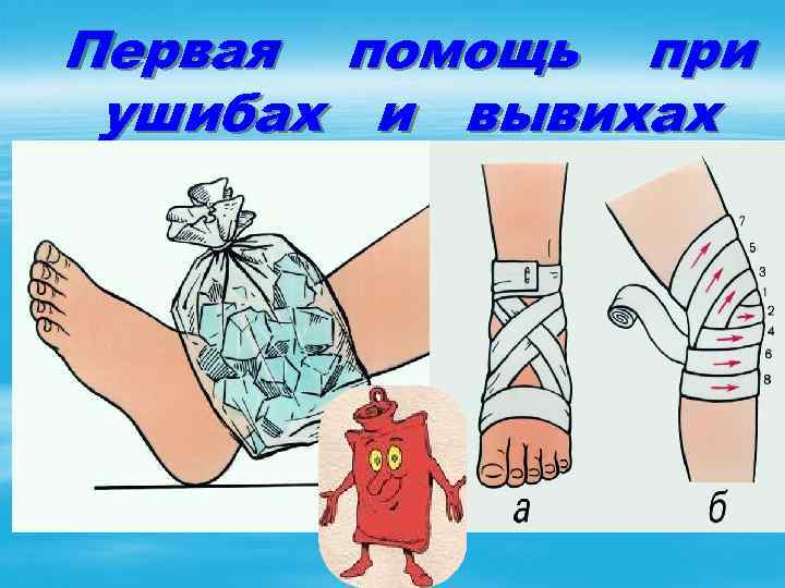 Первая ушибах помощь при и вывихах 