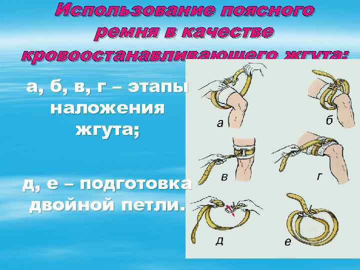 Использование поясного ремня в качестве кровоостанавливающего жгута: а, б, в, г – этапы наложения