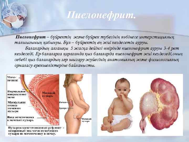 Пиелонефрит. n Пиелонефрит – бүйректің және бүйрек түбегінің көбінесе интерстициялық талшығының қабынуы. Бұл –