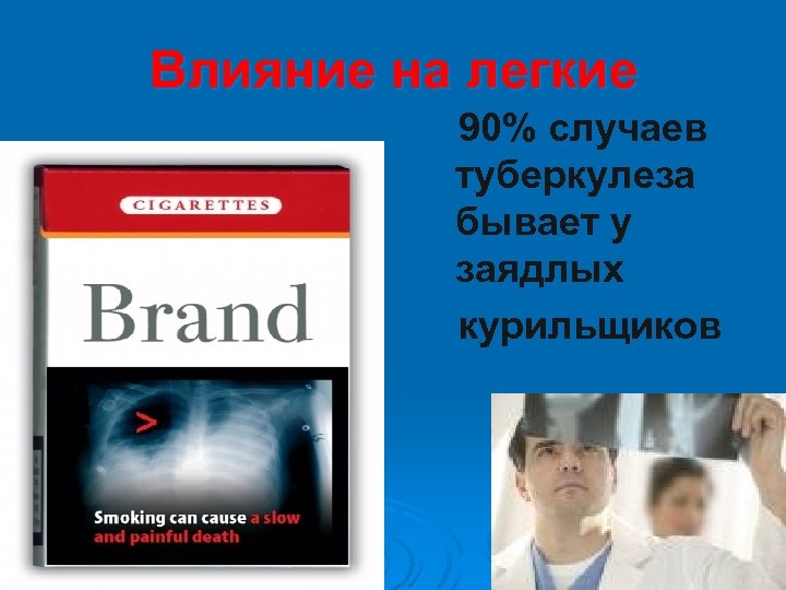 Влияние на легкие 90% случаев туберкулеза бывает у заядлых курильщиков 