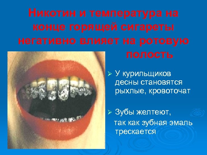 Никотин и температура на конце горящей сигареты негативно влияет на ротовую полость Ø У