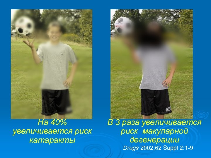 На 40% увеличивается риск катаракты В 3 раза увеличивается риск макуларной дегенерации Drugs 2002;