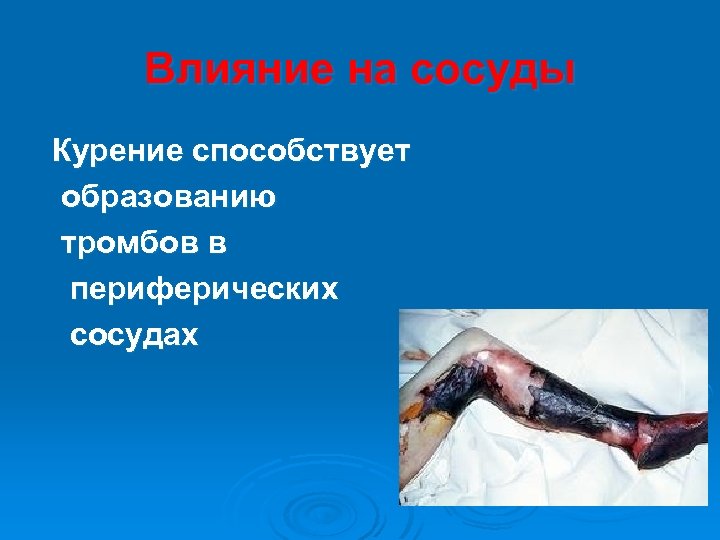 Влияние на сосуды Курение способствует образованию тромбов в периферических сосудах 