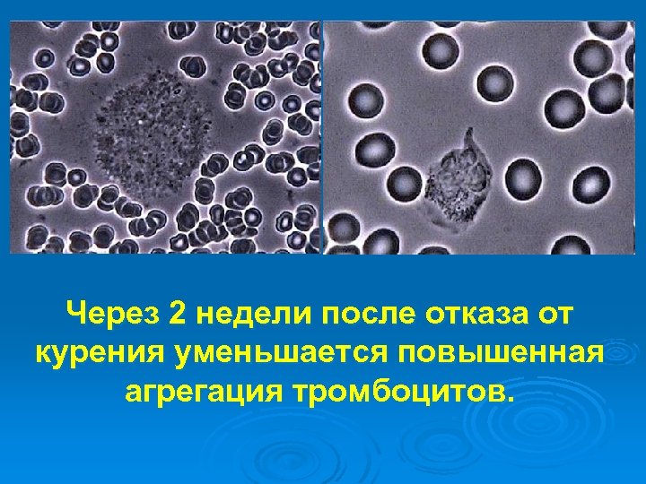 Через 2 недели после отказа от курения уменьшается повышенная агрегация тромбоцитов. 