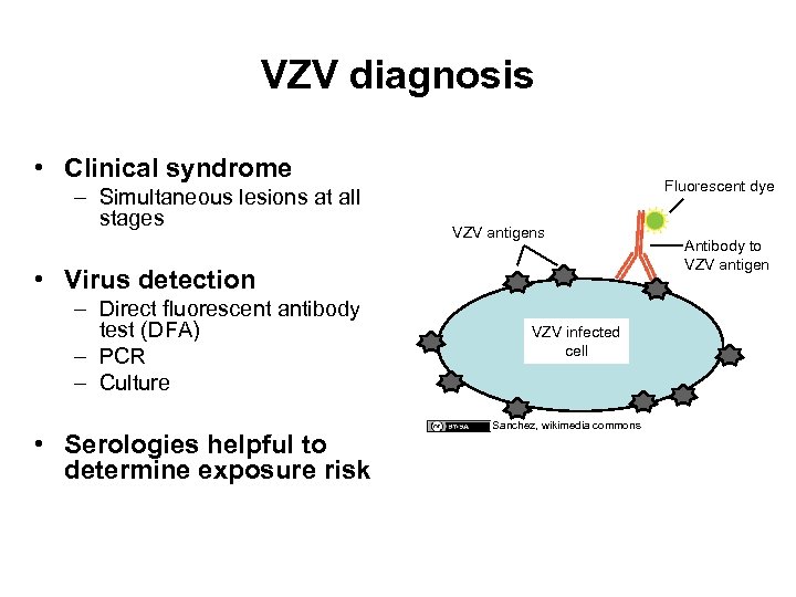 VZV diagnosis • Clinical syndrome – Simultaneous lesions at all stages Fluorescent dye VZV