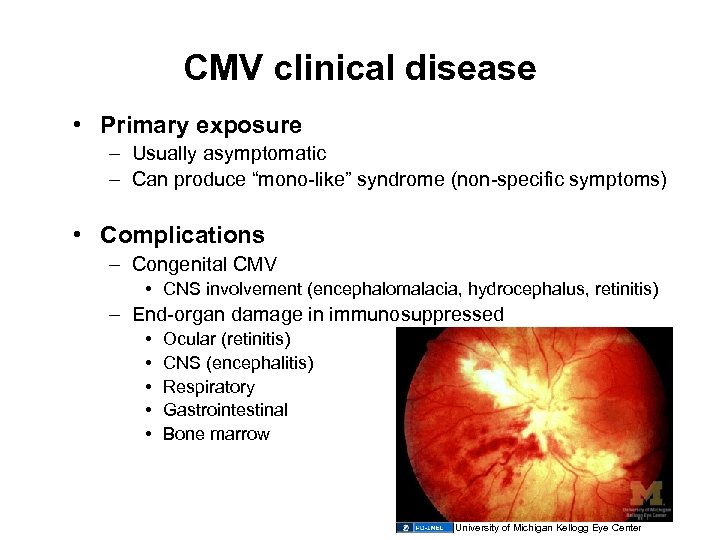 CMV clinical disease • Primary exposure – Usually asymptomatic – Can produce “mono-like” syndrome